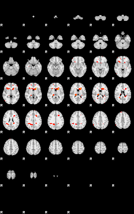 Patients 29413 50