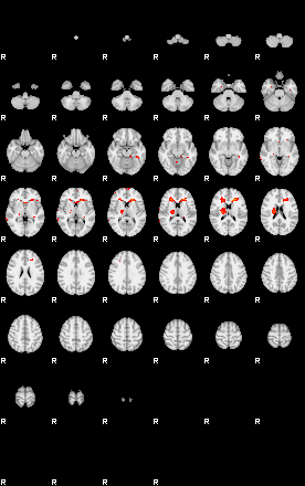 Patients 29417 51