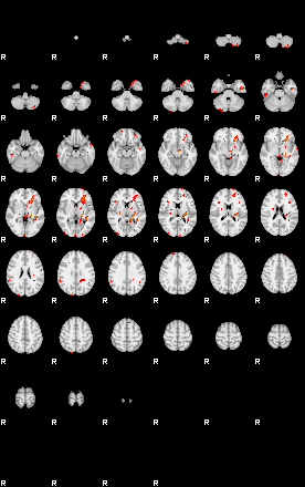 Patients 29433 148