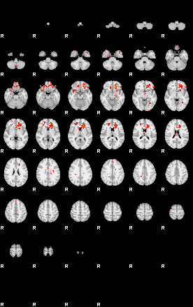 Patients 29511 21