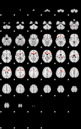 Patients 29549 4