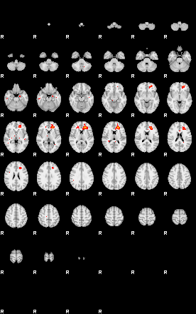 Patients 29669 195