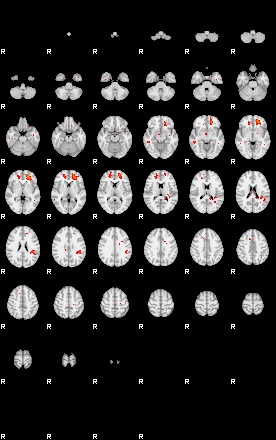 Patients 29670 189