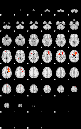 Patients 29884 199