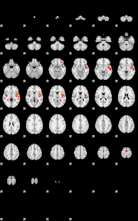 Patients 29175 84