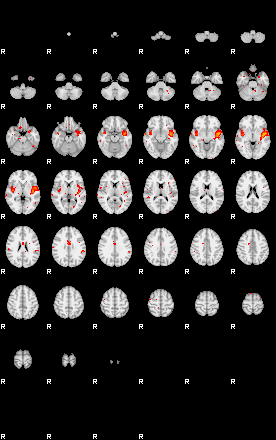 Patients 28820 35