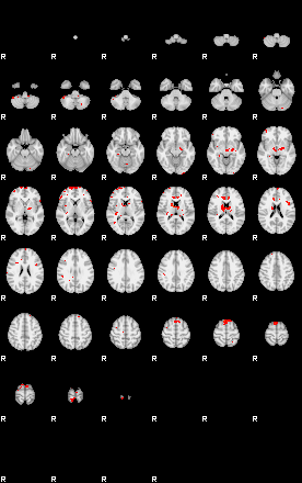 Patients 29415 17