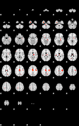 Patients 29659 186