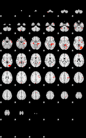 Patients 29052 120