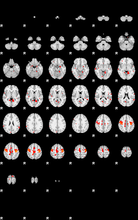 Patients 29161 92