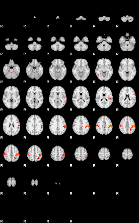 Patients 29511 93