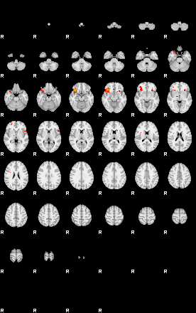 Patients 28819 38