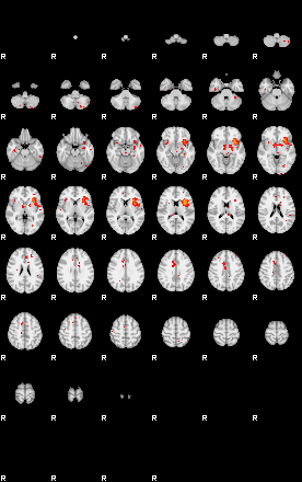 Patients 29218 61