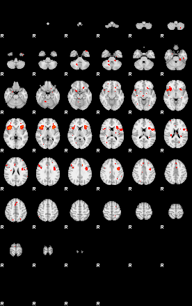 Patients 29206 188