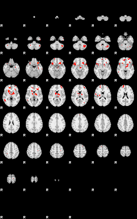 Patients 29013 45