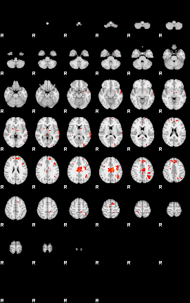 Patients 29433 192