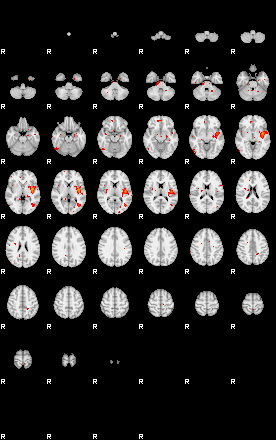 Patients 28817 89