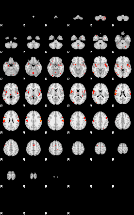 Patients 28920 143