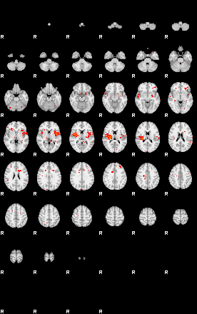 Patients 29007 175