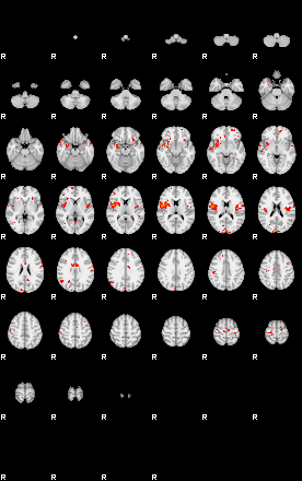 Patients 29012 163