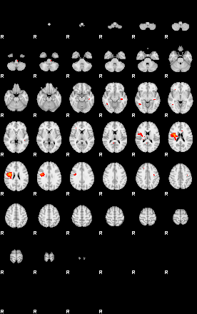 Patients 29059 133