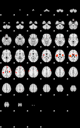 Patients 29108 192