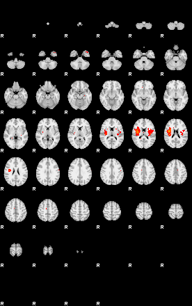 Patients 29112 141