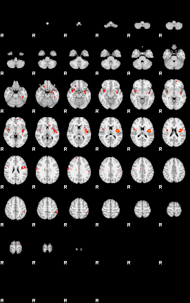 Patients 29155 163