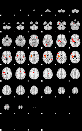 Patients 29155 176