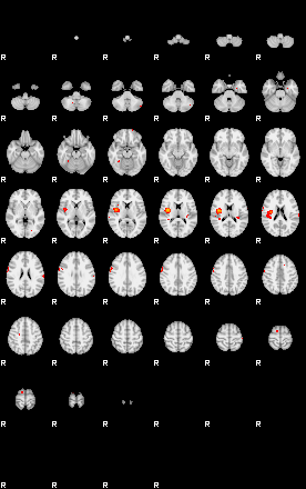 Patients 29171 163