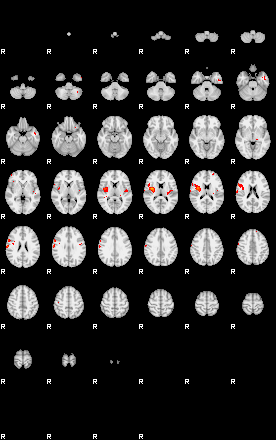 Patients 29178 161