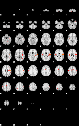 Patients 29186 60