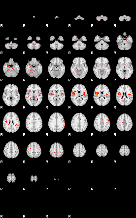 Patients 29188 152