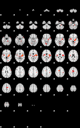 Patients 29194 84