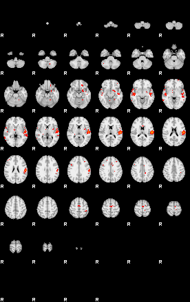 Patients 29280 130