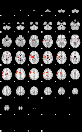 Patients 29391 16