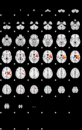 Patients 29410 84