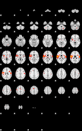 Patients 29174 169