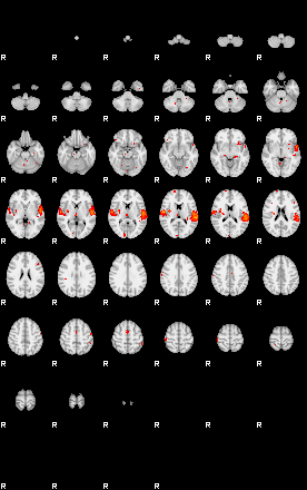 Patients 29162 159