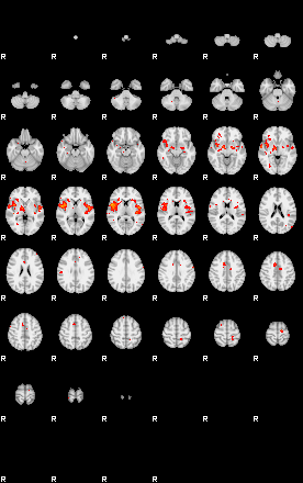 Patients 29182 164