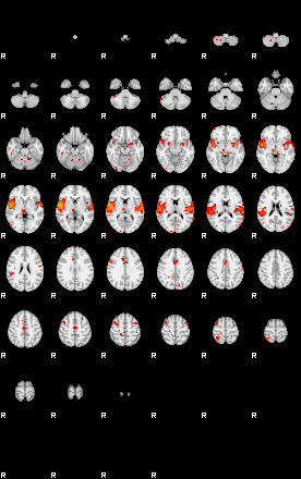 Patients 29659 154