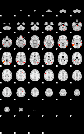 Patients 28810 124