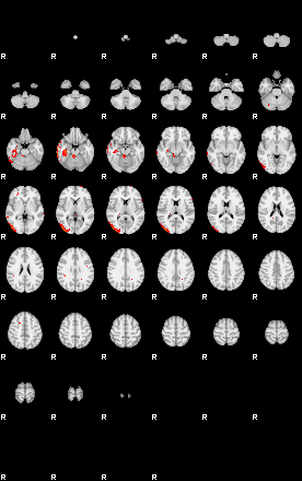 Patients 29152 190