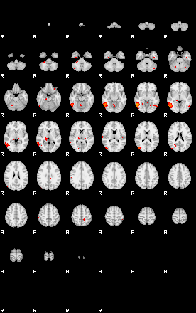 Patients 29217 22