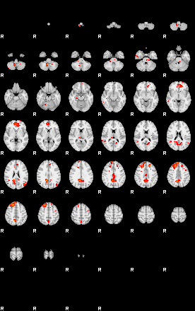 Patients 29203 187