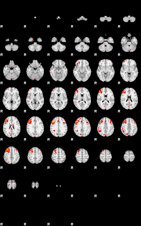 Patients 29010 140