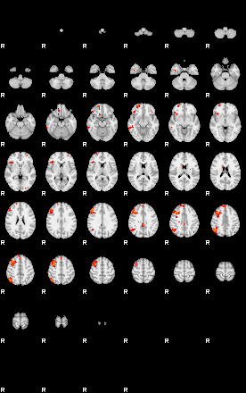 Patients 29394 43