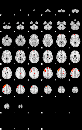 Patients 29502 199