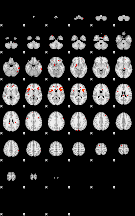 Patients 29006 15