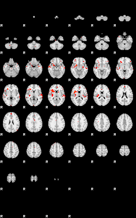 Patients 29009 79